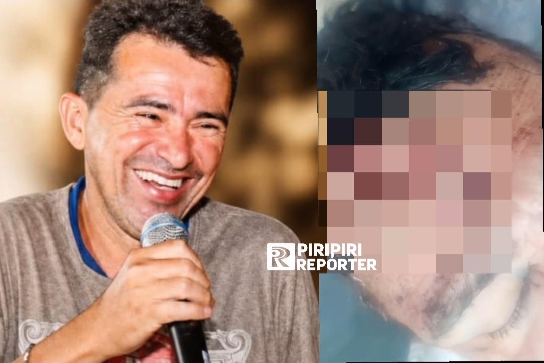 Homem fica em estado grave após s0frer acidente na zona rural de Piripiri 