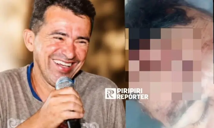 Homem fica em estado grave após s0frer acidente na zona rural de Piripiri 